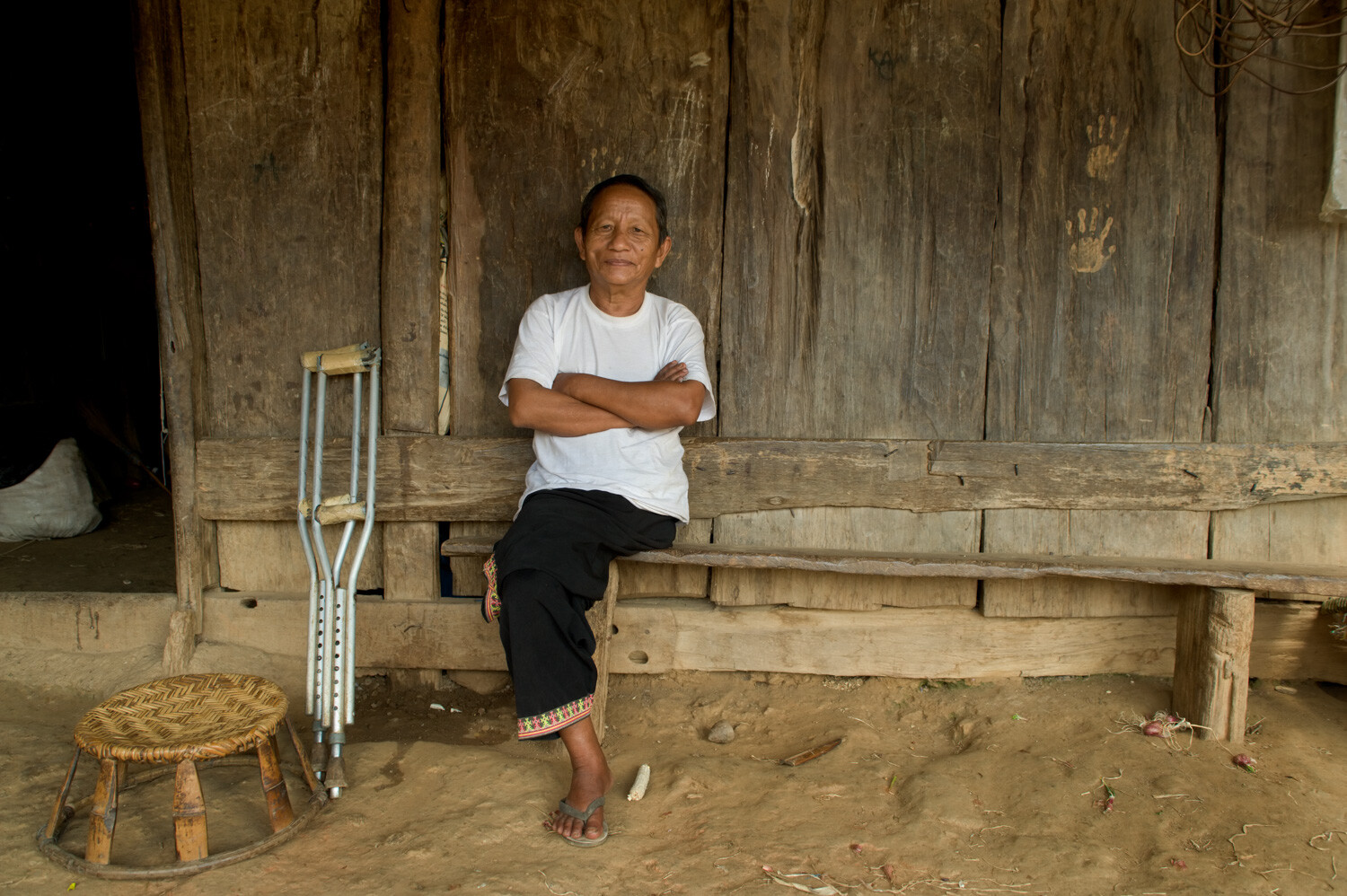 9 Tips for Better Environmental Portraits Hmong Amputee